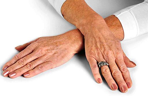 Возрастные изменения кожи рук требуют применения методик омоложения. 